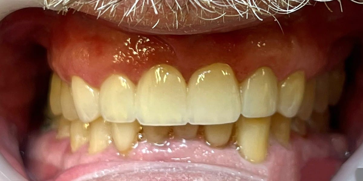 Before Restorative Dentistry - Patient 002